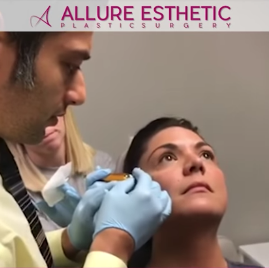 Under Eye Filler Injection | Tear Trough Filler with Cannula