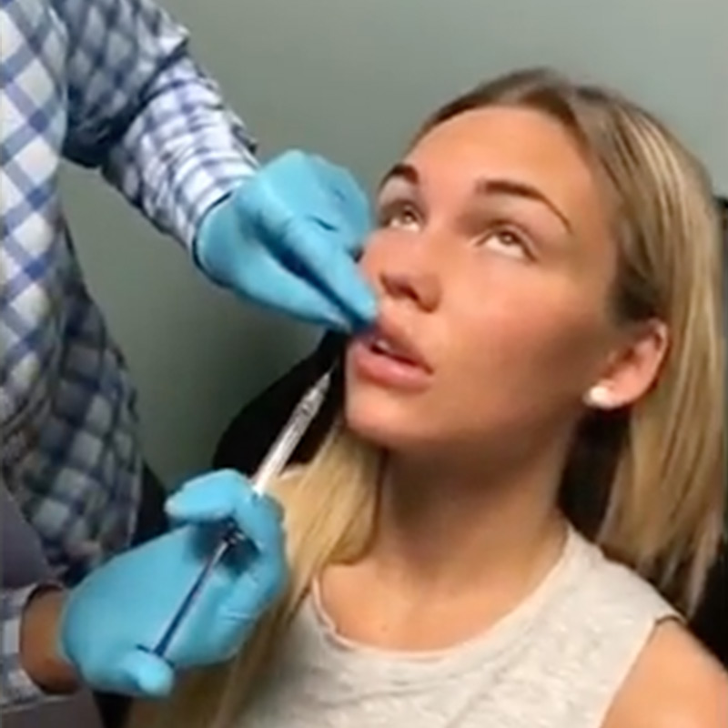 Lip Injection using Micro Droplet Technique