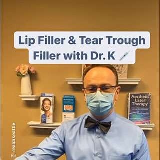 How Lip Filler & Under Eye Filler can TRANSFORM your Face! Full Injection!