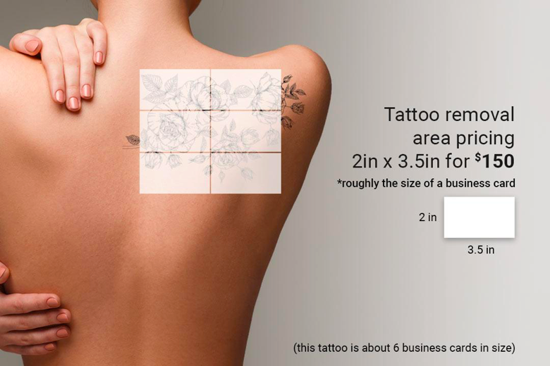 Tattoo Removal Center. Xtreme Tattoo Studio in Jayanagar 4th Block. Now Removing  tattoos is easier and safe as well. To Book appointment call:... | By  Xtreme Tattoo StudioFacebook